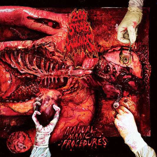 200 STAB WOUNDS : MANUAL MANIC PROCEDURES LP 180G