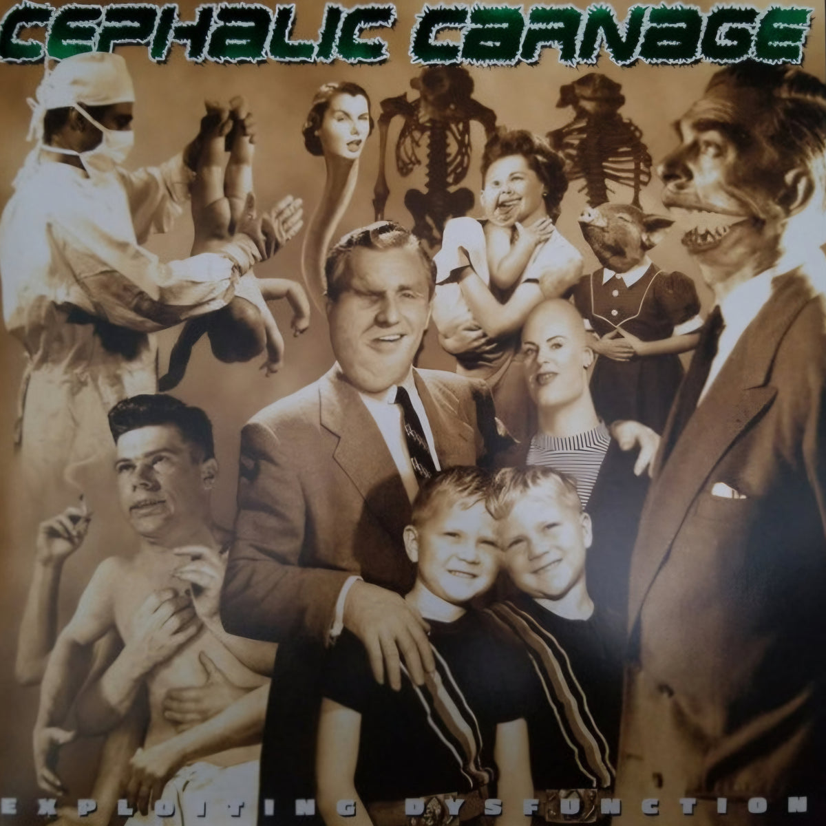 CEPHALIC CARNAGE : EXPLOITING DYSFUNCTION LTD 2LP 180G CUSTOM MERGE VINYL